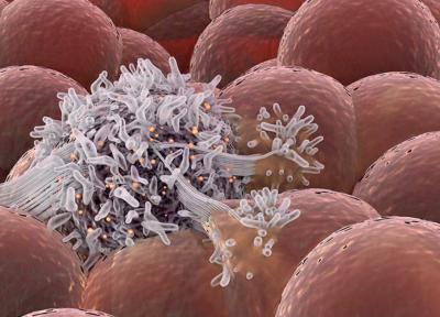 قرنطینه سلول های سرطانی برای جلوگیری از تغذیه و رشد آن ها